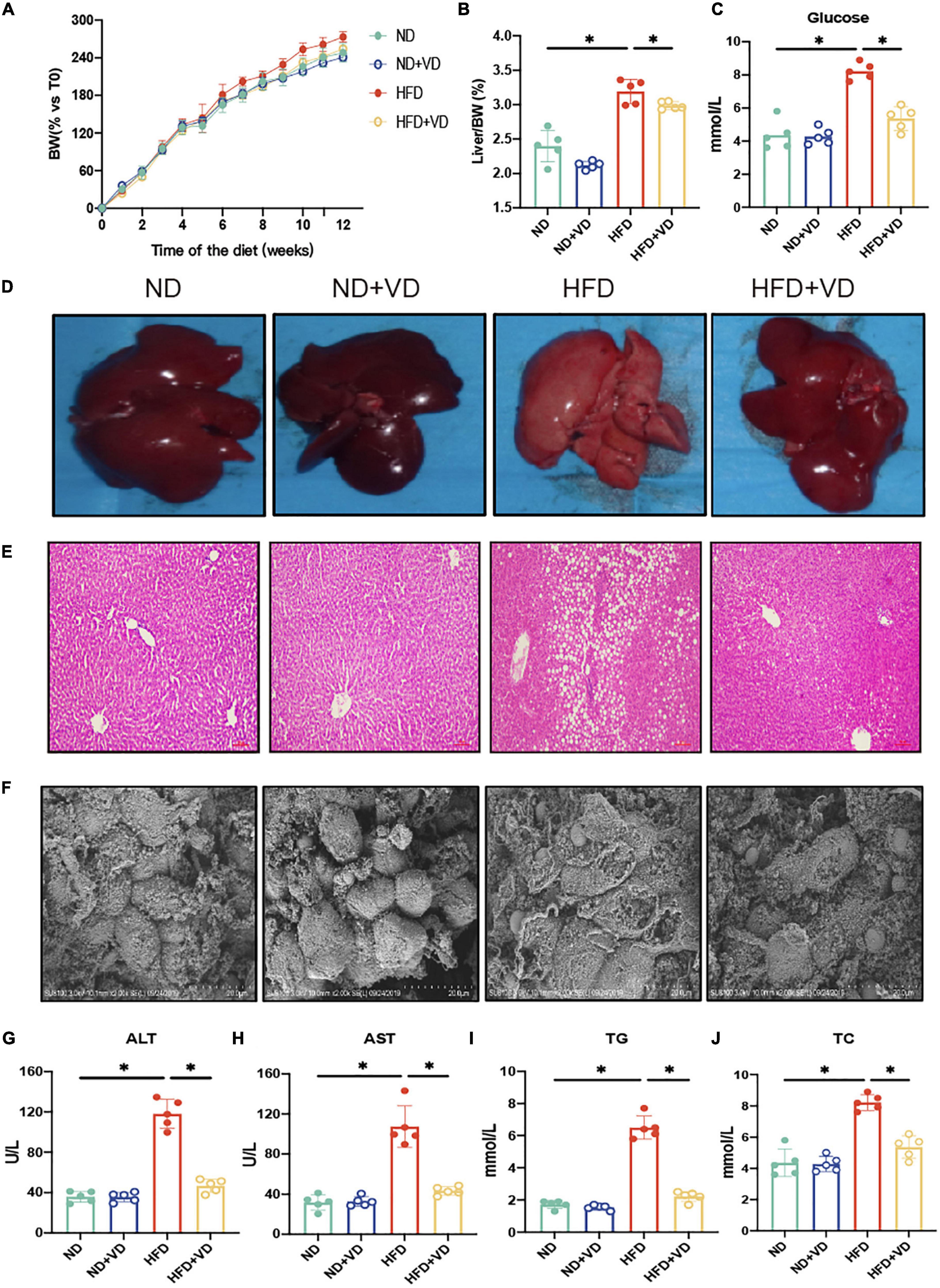 Vitamin D alleviates non-alcoholic fatty liver disease via restoring gut microbiota and metabolism